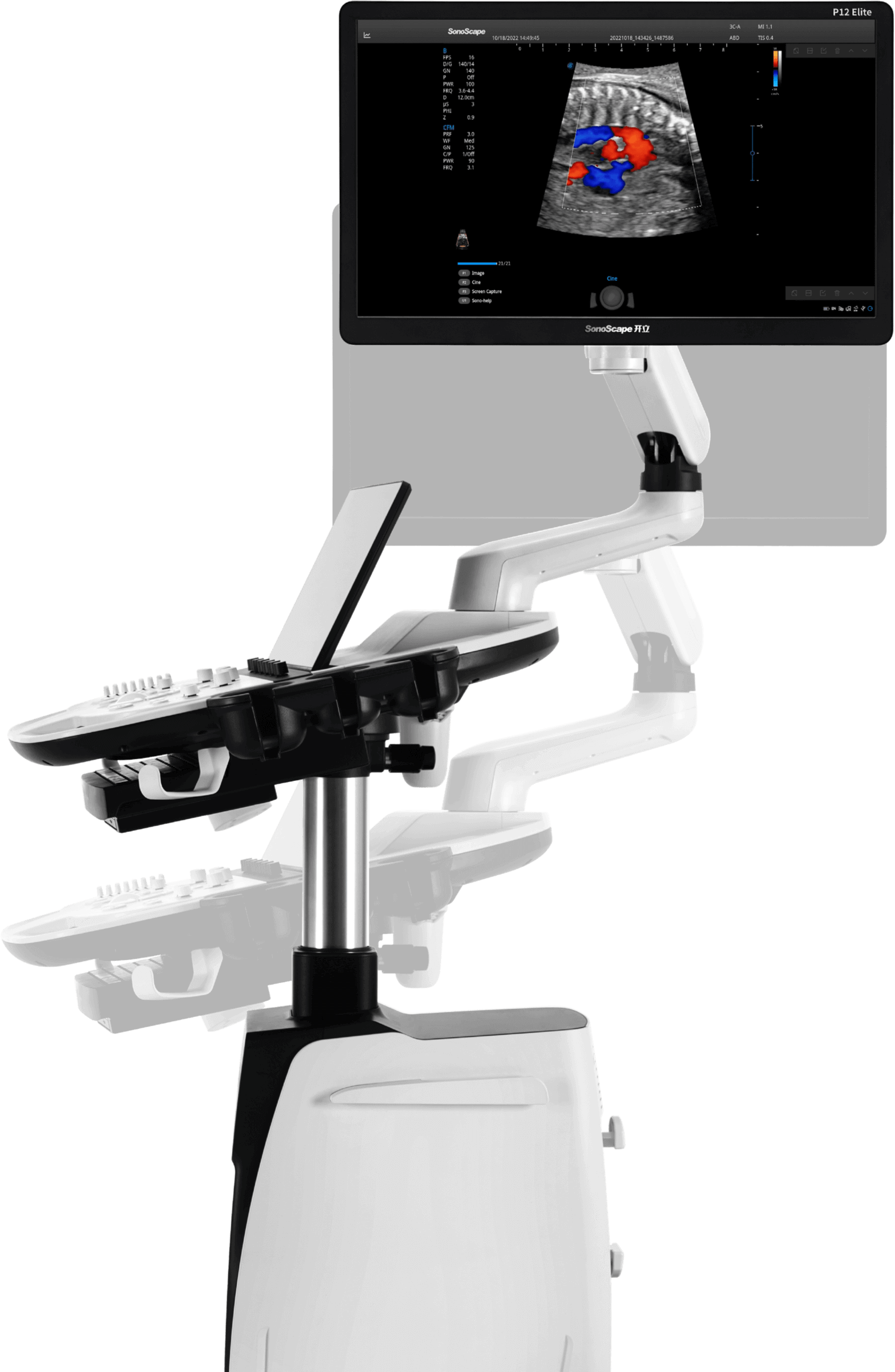 SonoScape P12 Elite Ultrasound