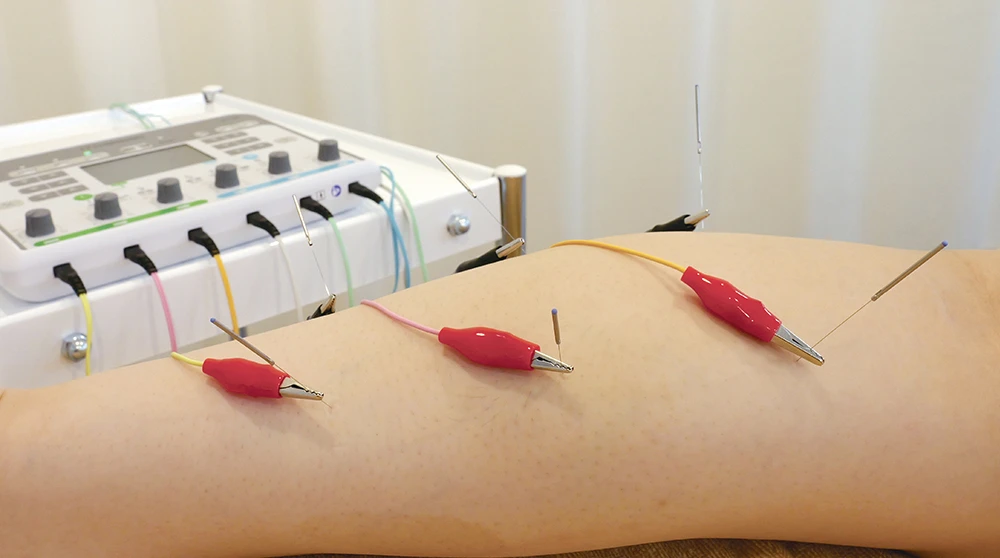 ITO ES-1601 – 6-Channel Advanced Programmable Electroacupuncture Workstation
