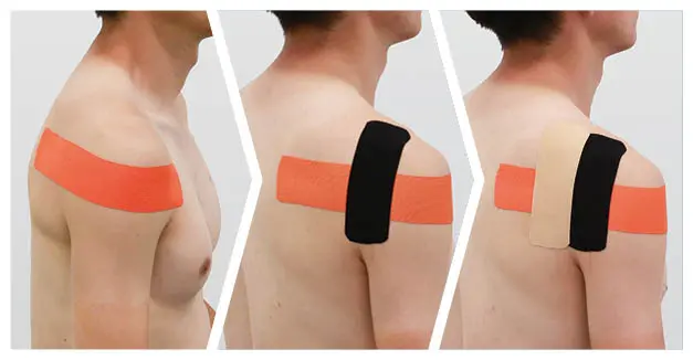ITO Olympia® – Breathable Water-Resistant Athletic Performance Kinesiology Tape