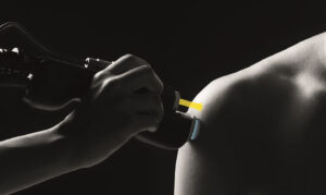 ASA Laser HIRO-TT Clinical Application