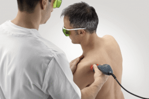ASA Laser MPHI-75 Clinical Application