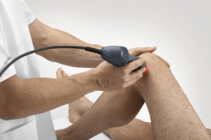 ASA Laser MPHI-75 Clinical Application