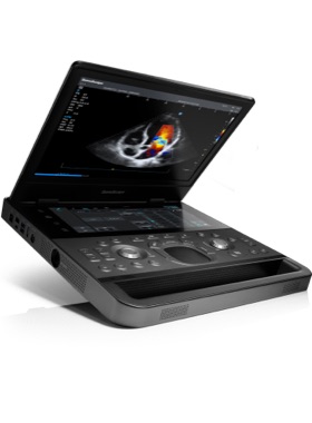 SonoScape® E11