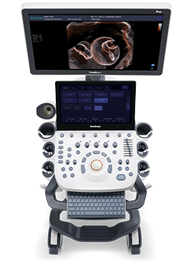 SonoScape® P20