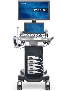 SonoScape® P50 Elite