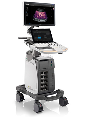 SonoScape® P60