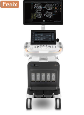 SonoScape® P70i