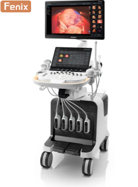 SonoScape® P80 Elite