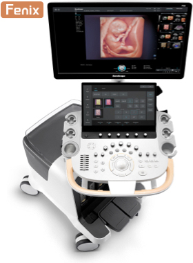 SonoScape® P80