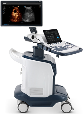 SonoScape® S60
