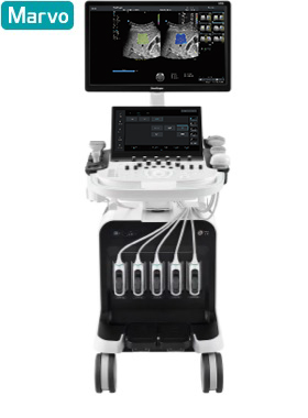 SonoScape® S70i