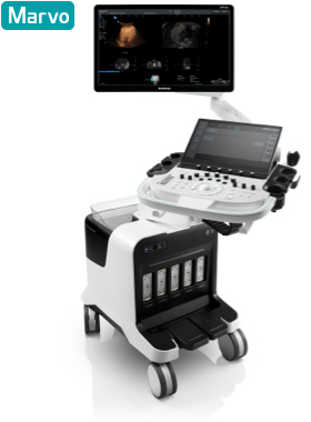 SonoScape® S80 Elite