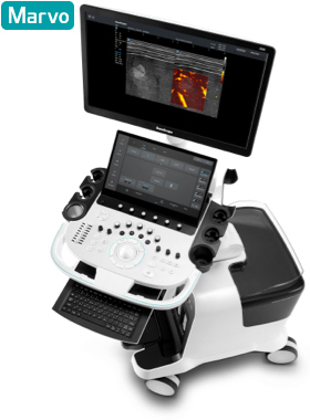 SonoScape® S80