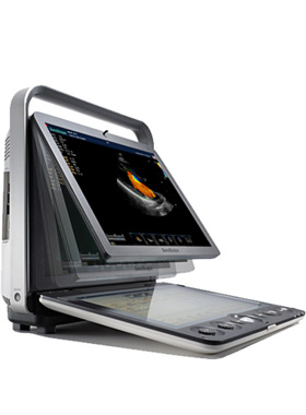 SonoScape® S9