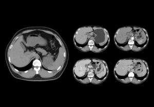 ANKE ANATOM S400 128-Slice CT Scanner - Image 4