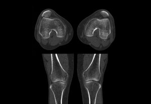 ANKE ANATOM S400 128-Slice CT Scanner - Image 5