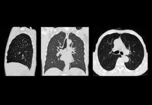 ANKE ANATOM S400 128-Slice CT Scanner - Image 8