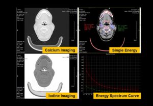 ANKE ANATOM S400 128-Slice CT Scanner - Image 9
