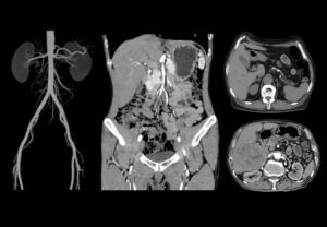 ANKE ANATOM S800 256-Slice CT Scanner - Image 4