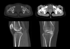 ANKE ANATOM S800 256-Slice CT Scanner - Image 5