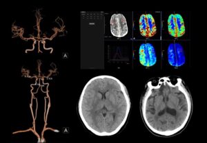 ANKE ANATOM S800 256-Slice CT Scanner - Image 7