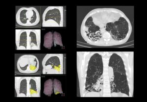 ANKE ANATOM S800 256-Slice CT Scanner - Image 8