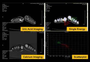 ANKE ANATOM S800 256-Slice CT Scanner - Image 10