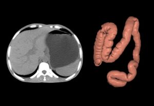ANKE ANATOM 64 Clarity 64-Slice CT Scanner - Image 2