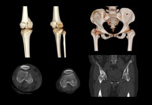 ANKE ANATOM 64 Clarity 64-Slice CT Scanner - Image 3