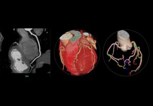 ANKE ANATOM 64 Clarity 64-Slice CT Scanner - Image 4