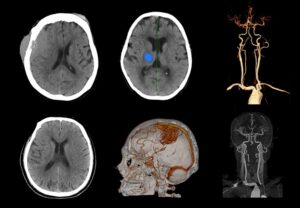 ANKE ANATOM 64 Clarity 64-Slice CT Scanner - Image 5