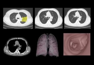 ANKE ANATOM 64 Clarity 64-Slice CT Scanner - Image 6