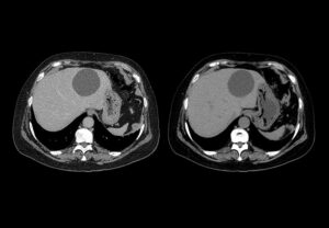 ANKE ANATOM 32 Fit / 64 Fit Computed Tomography System - Image 2