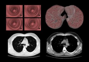 ANKE ANATOM 32 Fit / 64 Fit Computed Tomography System - Image 5