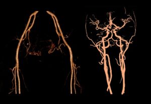ANKE ANATOM 32 Fit / 64 Fit Computed Tomography System - Image 6