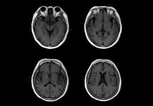 ANKE OPENMARK 4000 C-Shape Open MRI System - Image 3