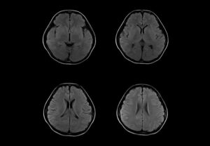 ANKE OPENMARK 4000 C-Shape Open MRI System - Image 4