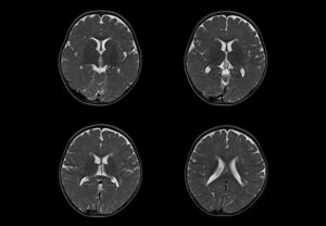 ANKE OPENMARK 4000 C-Shape Open MRI System - Image 6