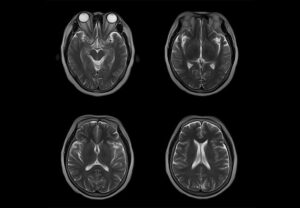 ANKE OPENMARK 4000 C-Shape Open MRI System - Image 2