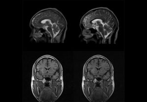 ANKE OPENMARK 4000 C-Shape Open MRI System - Image 5