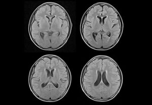 ANKE OPENMARK 5000 Midfield Open MRI System - Image 3