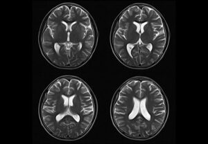 ANKE OPENMARK 5000 Midfield Open MRI System - Image 2