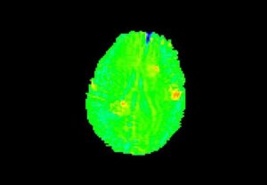 ANKE SuperMark 1.5T Superconducting MRI System - Image 6