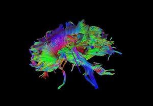 ANKE SuperMark 1.5T Superconducting MRI System - Image 7