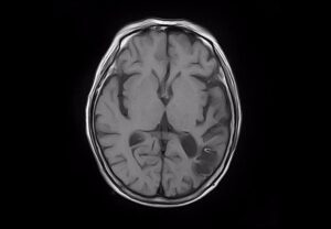 ANKE SuperMark 1.5T Superconducting MRI System - Image 2
