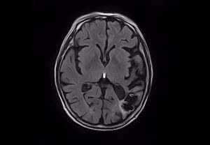 ANKE SuperMark 1.5T Superconducting MRI System - Image 4