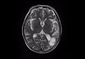 ANKE SuperMark 1.5T Superconducting MRI System - Image 3